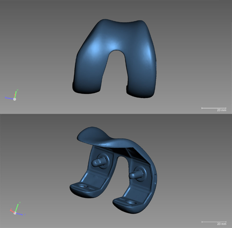 膝关节植入物3D数据